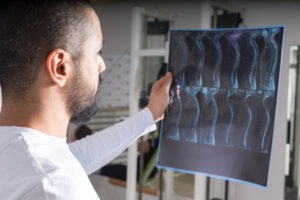 a radiologist checking x-ray images for signs of spinal injury